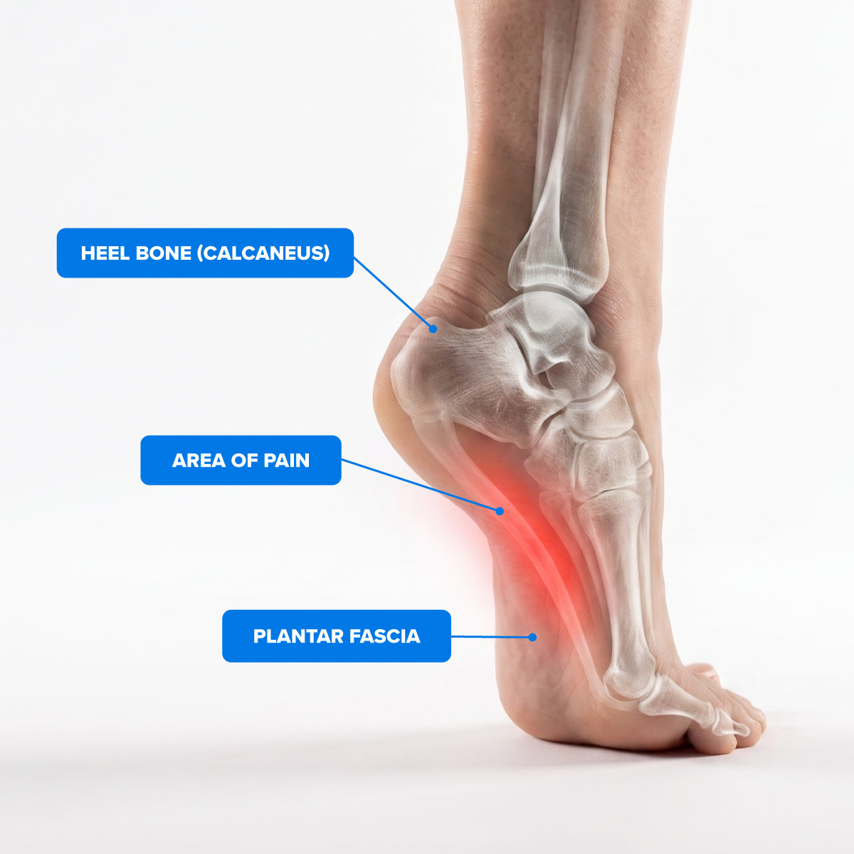 Koprez® Ankle Sleeve